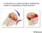 concussion - Post-Concussion Healing