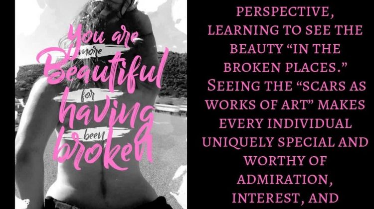 You are more beautiful...pushliving 3 750x420 - Acceptance of Loss, Illness and Disability: Broken but Stronger
